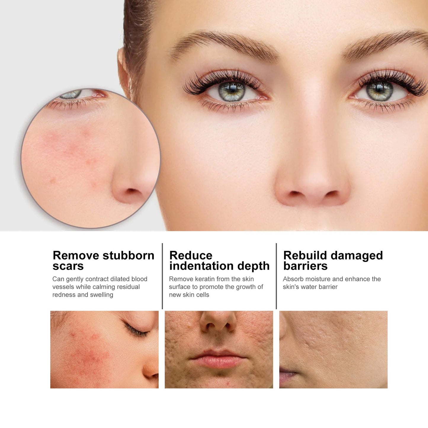 Niacinamide Facial Serum