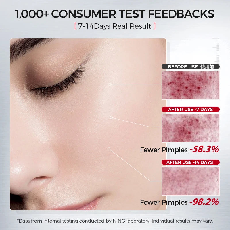 Amino Acid Salicylic Cleanser