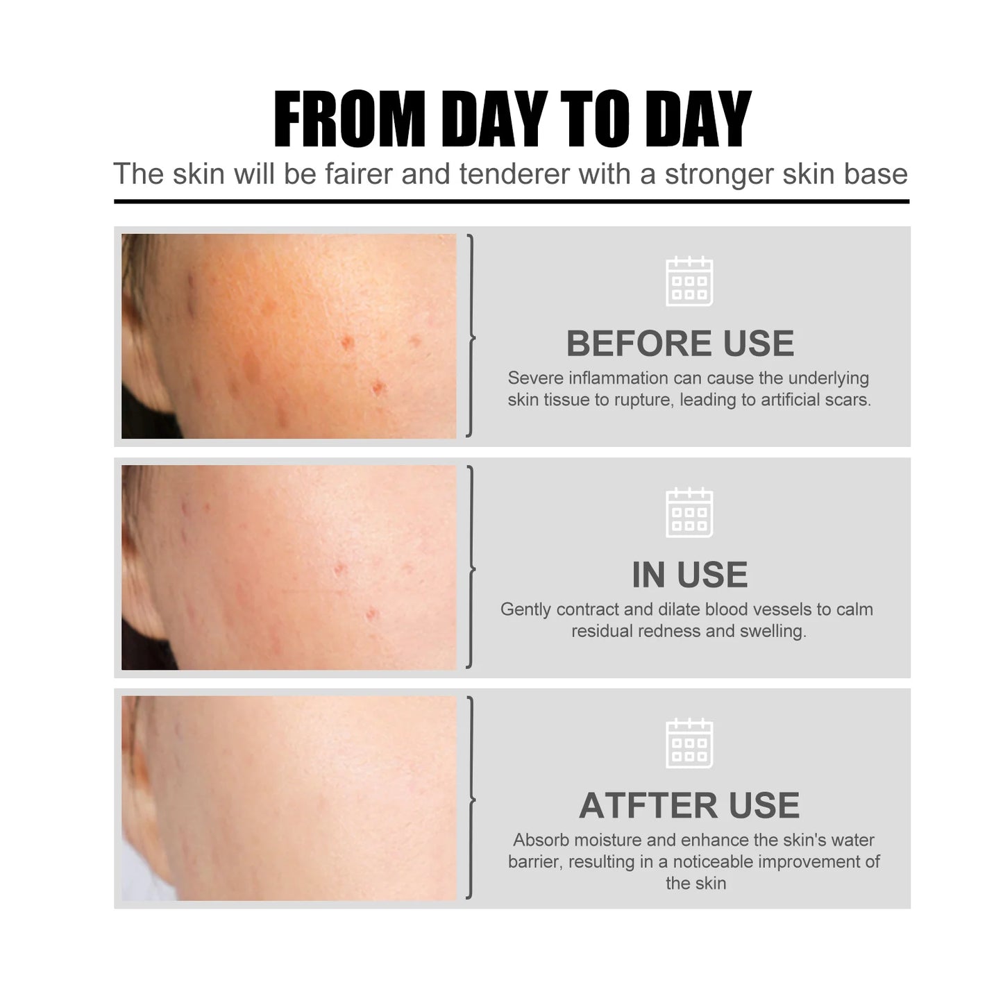 Niacinamide Facial Serum