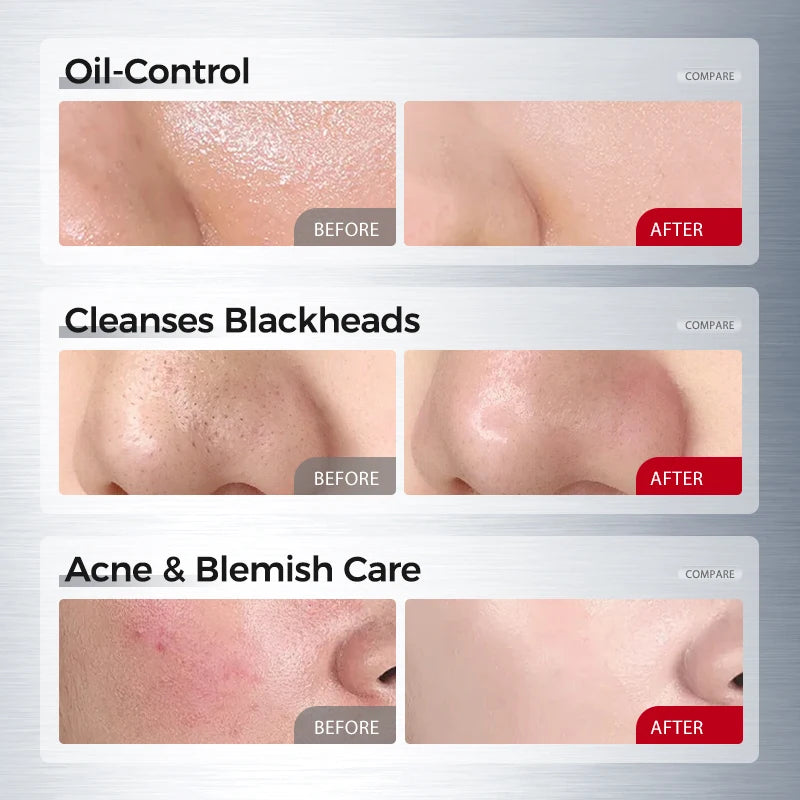 Amino Acid Salicylic Cleanser